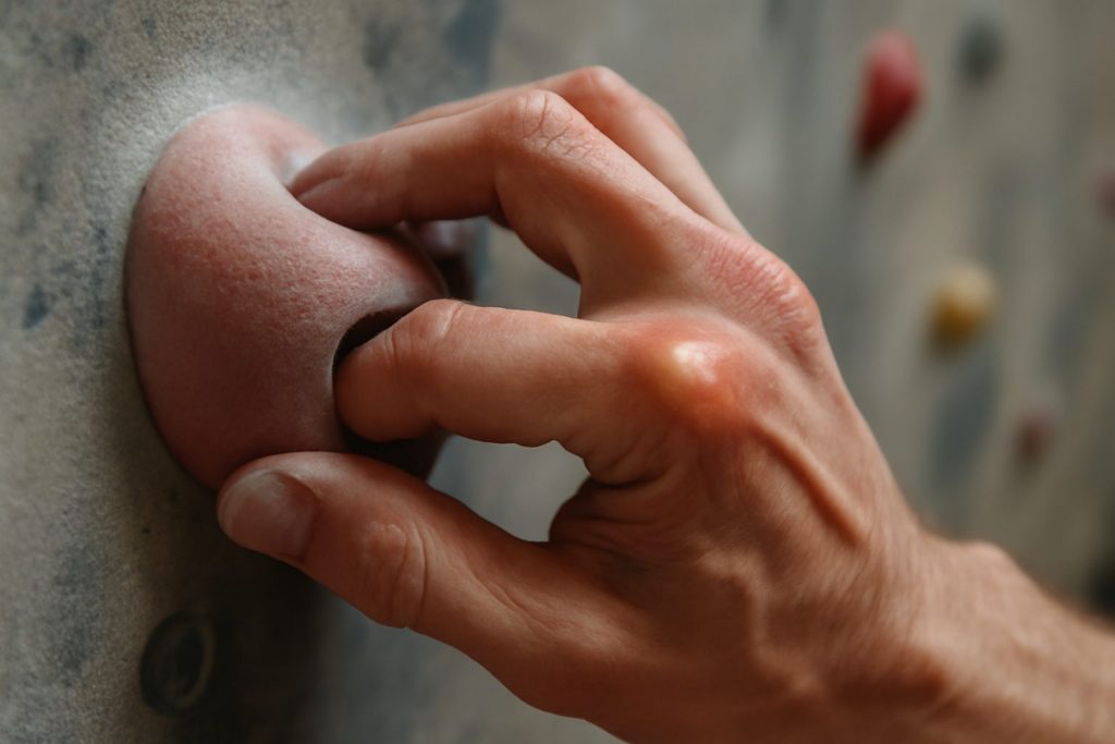 découvrez les causes, symptômes et traitements du kyste de poulie pour mieux comprendre et gérer cette affection courante des doigts.