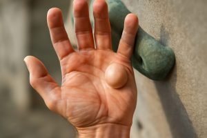 découvrez les causes, symptômes et solutions pour un kyste sur la paume de la main. apprenez à reconnaître et traiter cette affection pour soulager votre main efficacement.